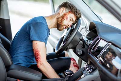 A man that is passed out on his steering wheel after a head-on collision. 